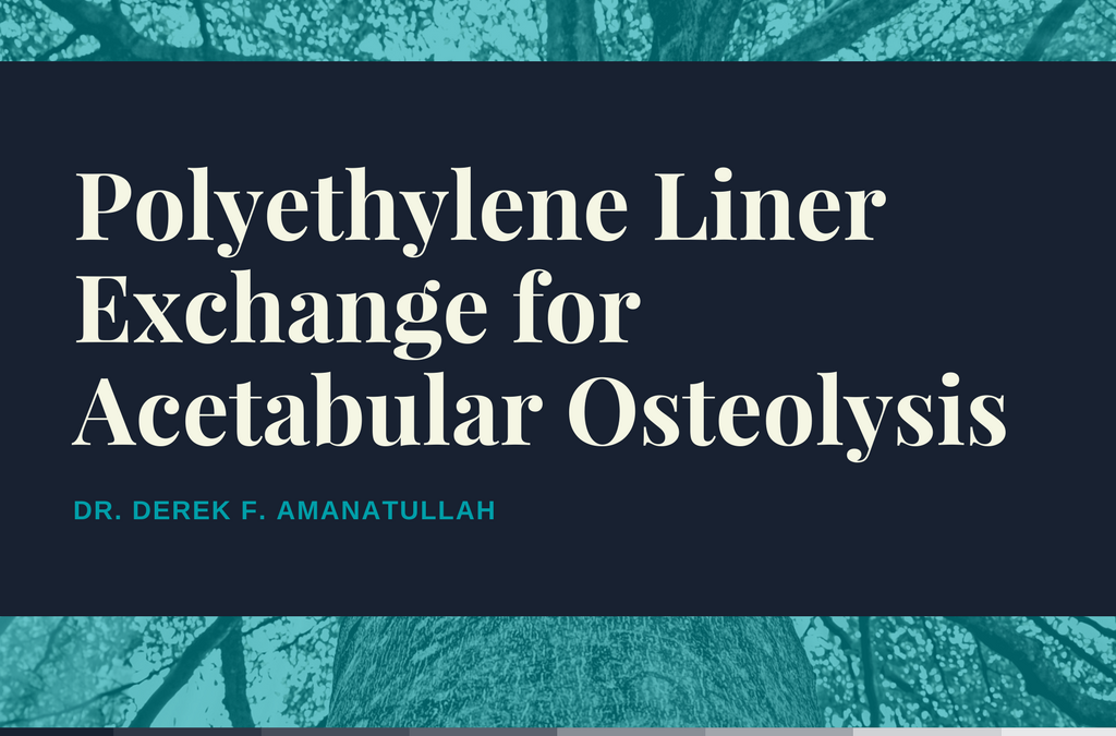 Polyethylene Liner Exchange for Osteolysis