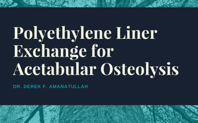 Polyethylene Liner Exchange for Osteolysis
